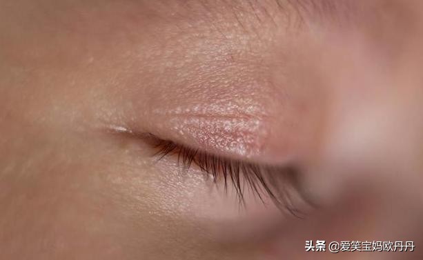 什么原因会导致小孩眼屎很多,最近宝宝的眼屎多是怎么回事