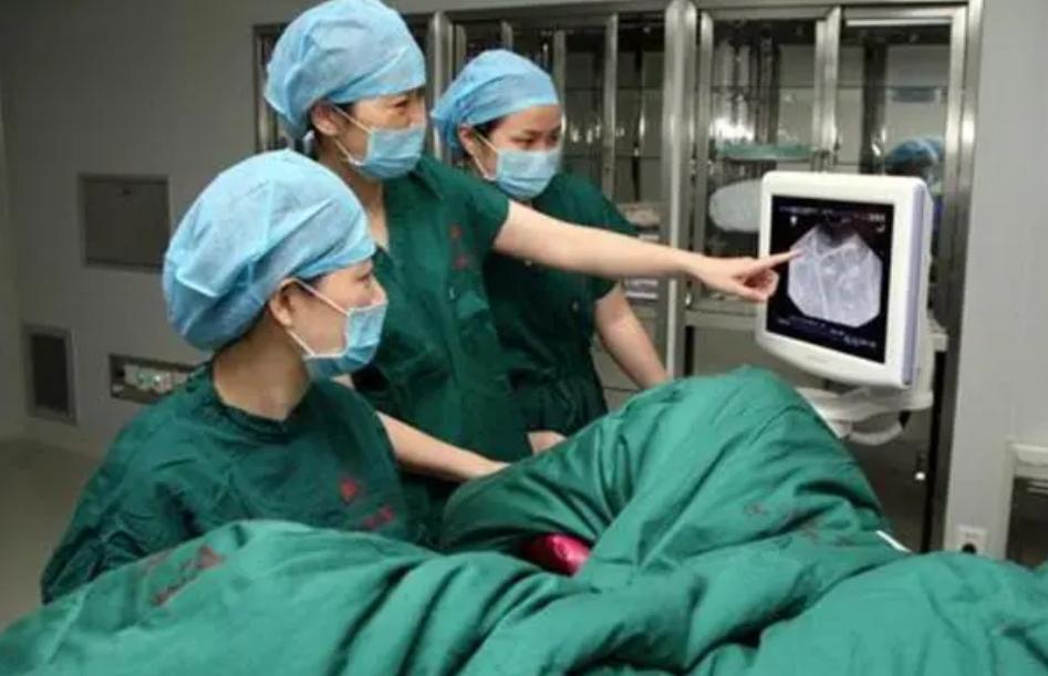 小s剖腹产3次还是4次,小s剖腹产怎么修复的