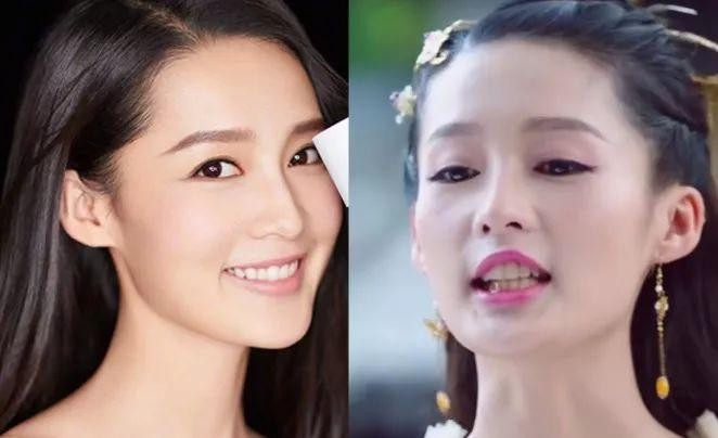 教你一个小妙招牙齿黄不用担心,教你治牙黄