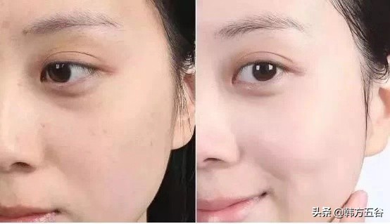 搓澡之后毛孔有血点怎么弄掉,搓出皮肤脏东西