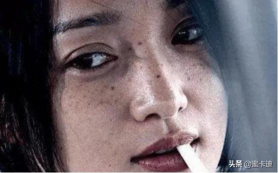 全部皮肤知识大全,四张图让你明白你是什么皮肤