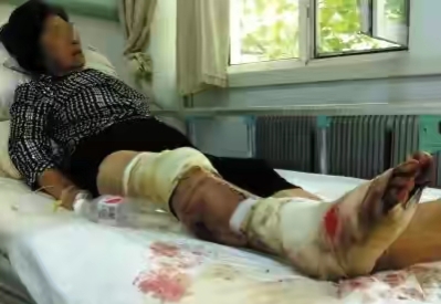 夜钓遇到毒蛇被咬,养毒蛇怎样防止被咬