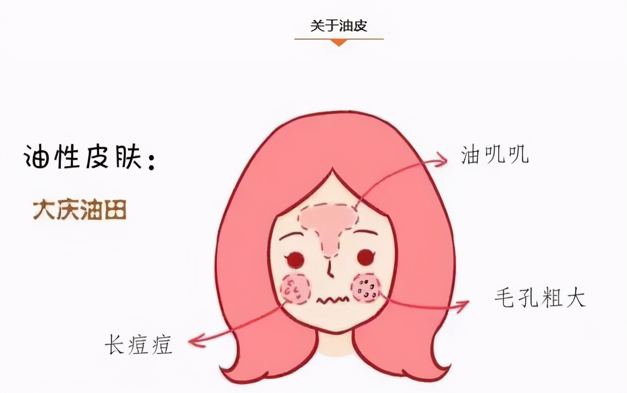 皮肤出油毛孔粗大如何改善,改善毛孔粗大出油用什么洗面奶