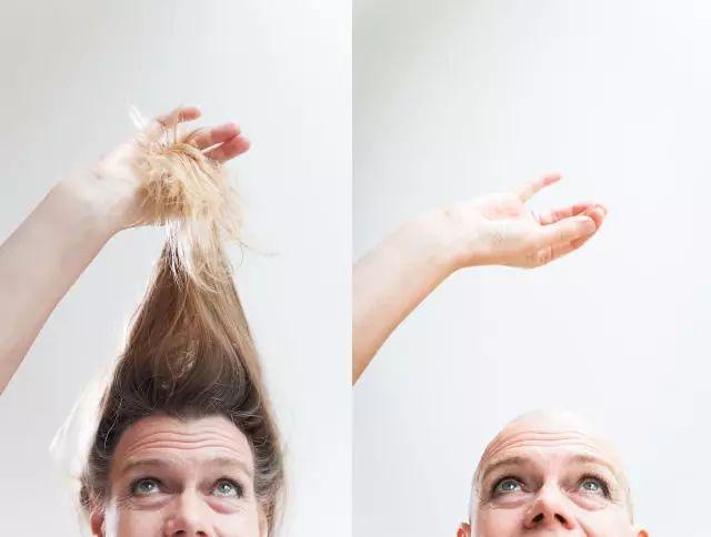 脚气臭脚解决方法,脚气臭汗