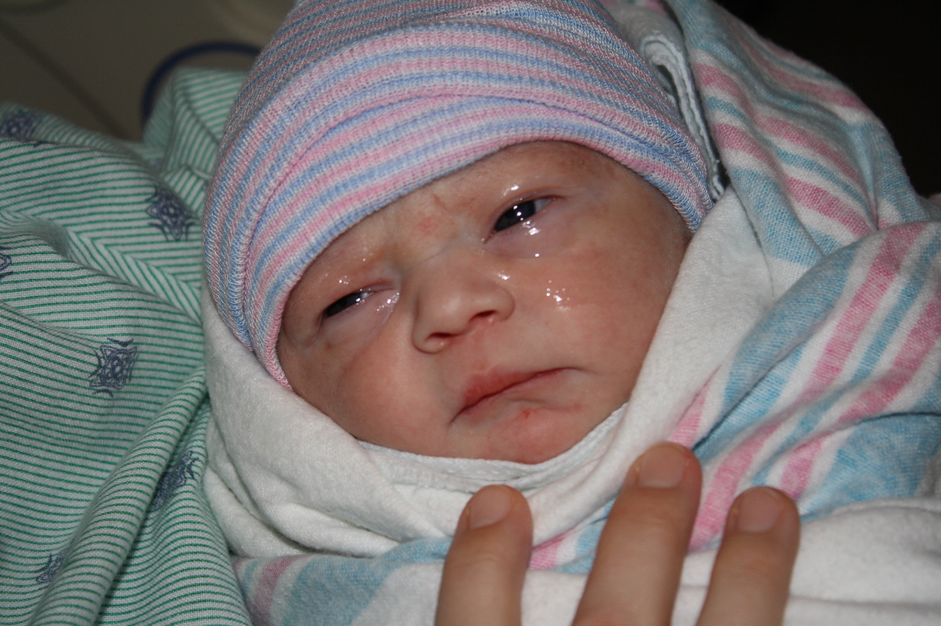 新生儿单侧眼屎多流眼泪,新生儿眼屎多怎么办