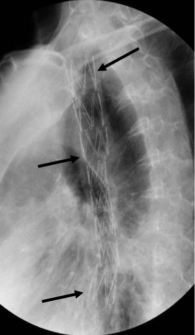 想吃却吃不下饭怎么办,想吃又不能吃怎么办