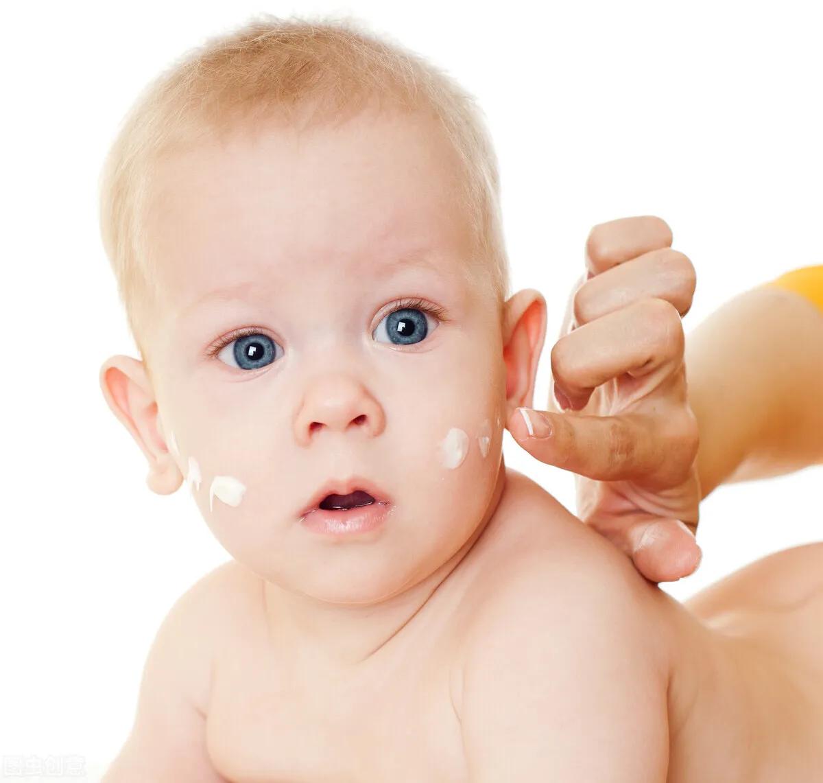 宝宝手脚干裂起皮怎么办,手脚干裂脱皮还有点疼怎么回事