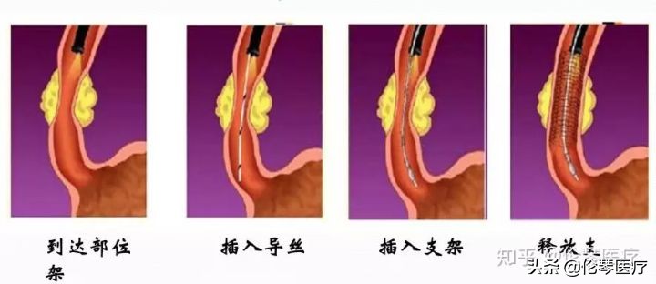瑞金医院王忠敏,瑞金医院王忠敏简介