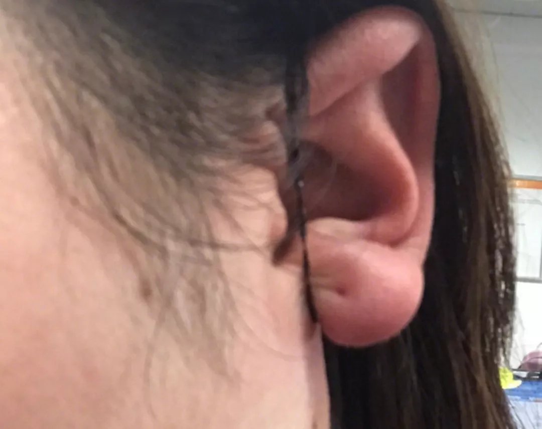 护肤小常识点赞,4个亲测护肤小妙招