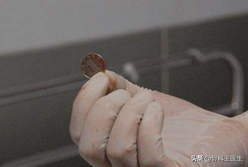 为什么会有人塞异物到直肠里,为什么会有人往尿道里塞异物