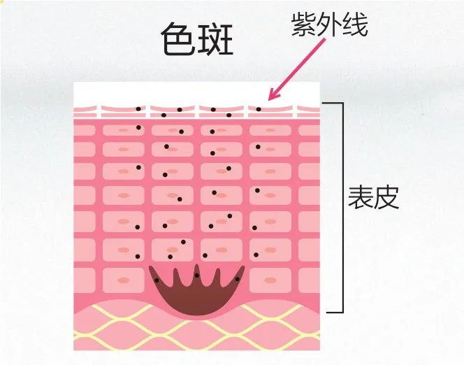 秦海璐晒到脱皮，陈伟霆晒成炭黑色，三角涂抹抗UV护理