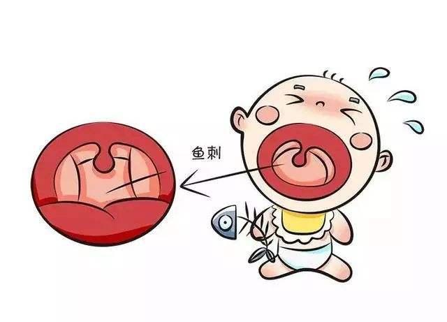 喉咙卡住鱼刺几天了怎么处理,三岁小孩被鱼刺卡住怎么处理