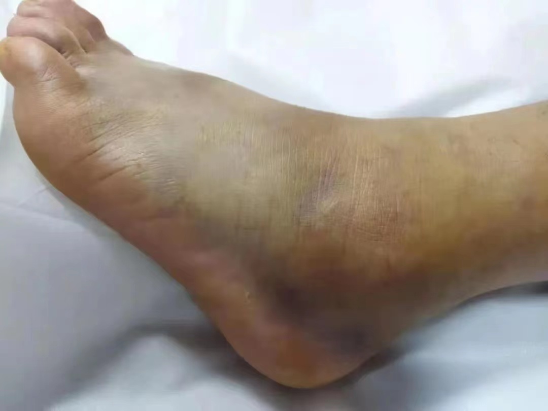 开通绿色通道抢救患者生命,绿色通道救治