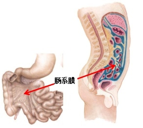 小孩肠系膜淋巴结炎腹痛怎么办,肠系膜淋巴结炎和小儿疳积
