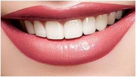 明星的烤瓷牙都怎么样了,明星都爱的烤瓷牙原来是这样的