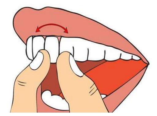 如果牙齿松了几个月了该怎么办,牙齿松了不要管它可以吗