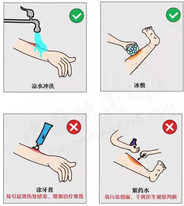 暖宝宝低温烫伤黑印怎么消除,暖宝宝轻度低温烫伤能自愈吗