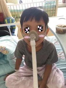 无创呼吸机辅助通气禁忌,什么样的宝宝不适合推拿