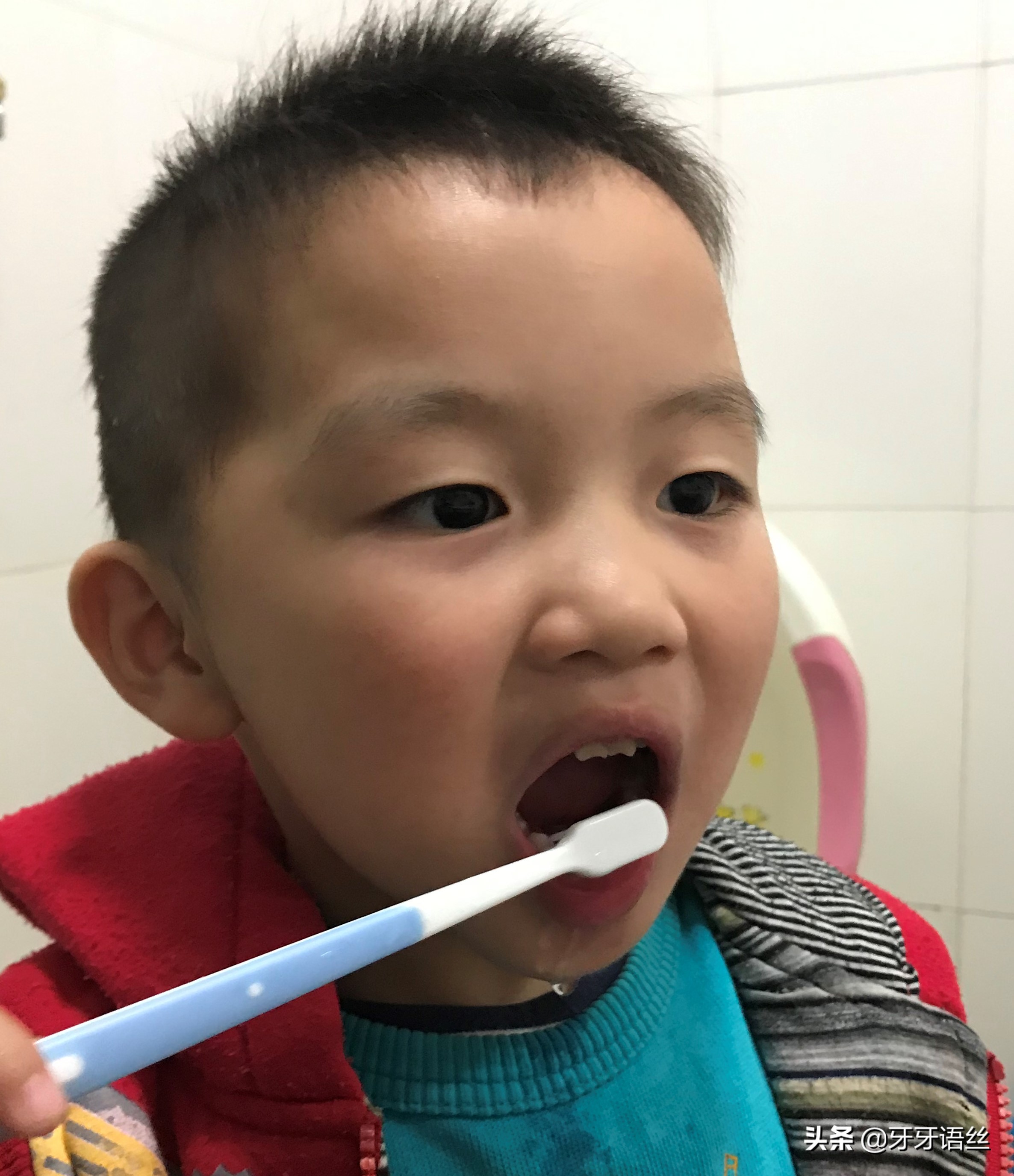 儿童龋齿的病因及预防诊治,儿童龋齿的病因及预防