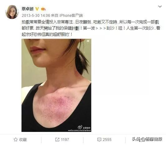 年过三十面部下垂，告诉你提拉紧致的秘技