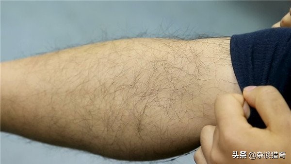 双性人的心理变化,双性人有两个性特征吗