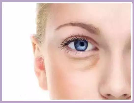 这些年我们踩过的护肤坑,目前最靠谱的去眼袋方法