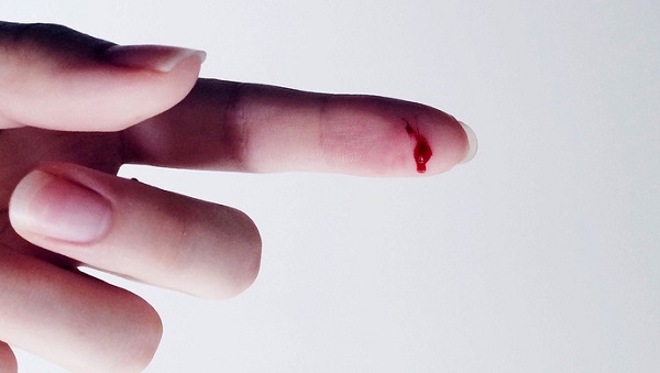 心梗脚趾头放血有用吗,心脏猝死扎脚尖放血能急救吗