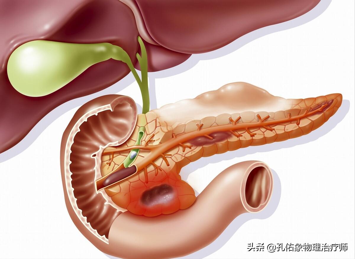 肩周炎肩膀疼痛用什么药,肩膀疼是肩周炎吗还是其他原因