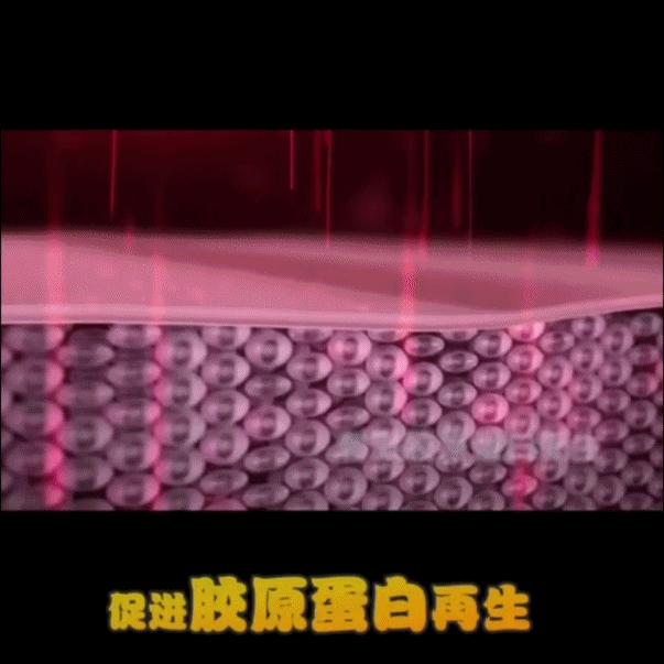 光了嫩肤后皮肤会变光滑吗,皮肤黑光子嫩肤10天变化图片