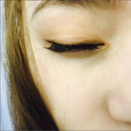 双眼皮贴杨幂同款,杨幂林允同款双眼皮贴