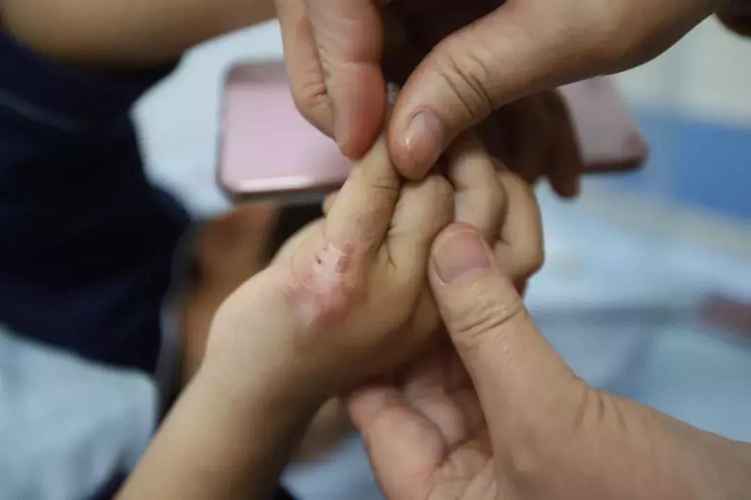 8岁男孩被泼开水后续,痛心七岁男童落水竟没人管