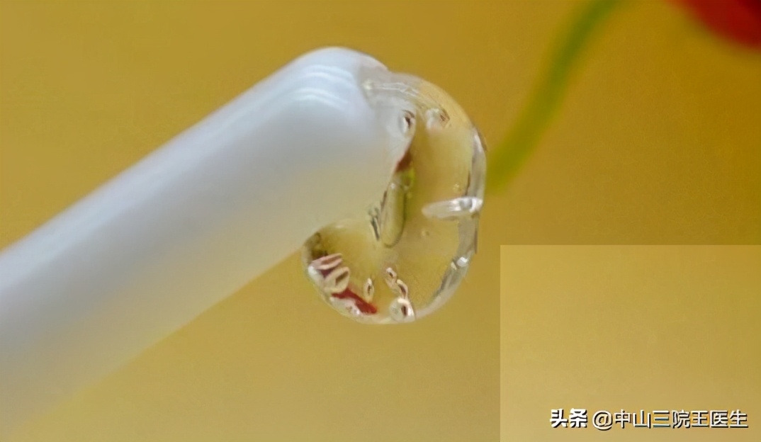 女性宫颈病变的原因,女性蹲马桶会有什么危害