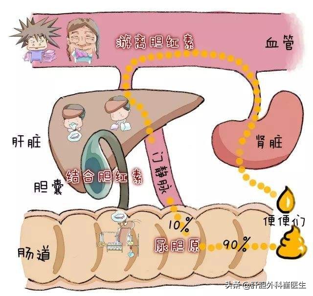 体检查出胆红素高是怎么回事,体检报告胆红素偏高的原因及危害