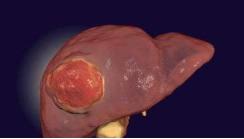 突发肚子疼呕吐是阑尾炎吗,突发恶心腹痛是什么原因