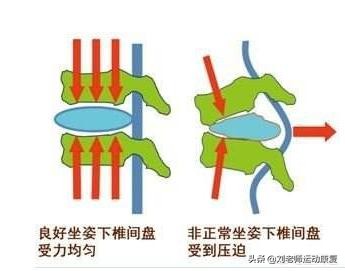 腰疼、腰突患者自我康复新疗法《牵引复位训练》，恢复腰椎功能