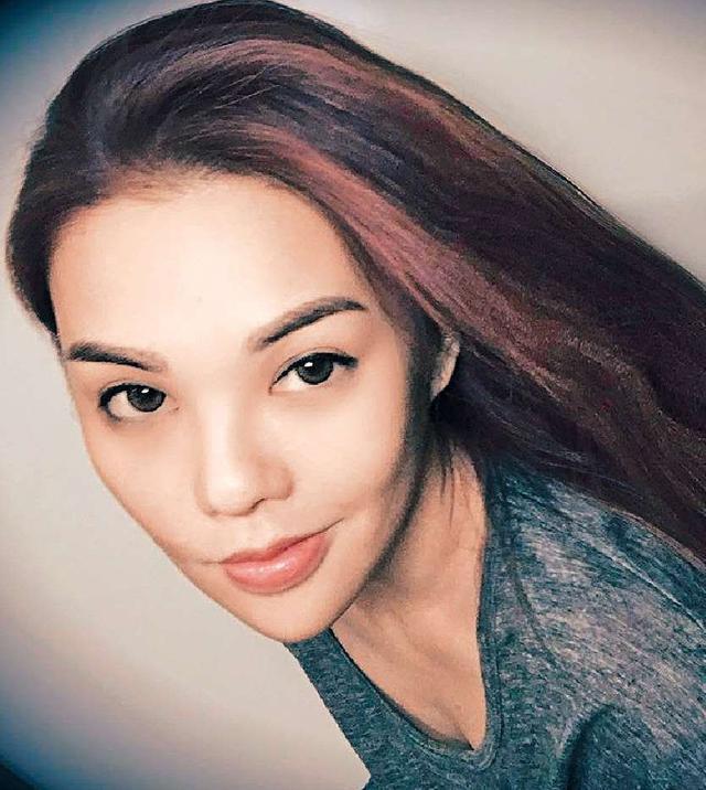 抽脂减肥成了植物人,整形抽脂死亡