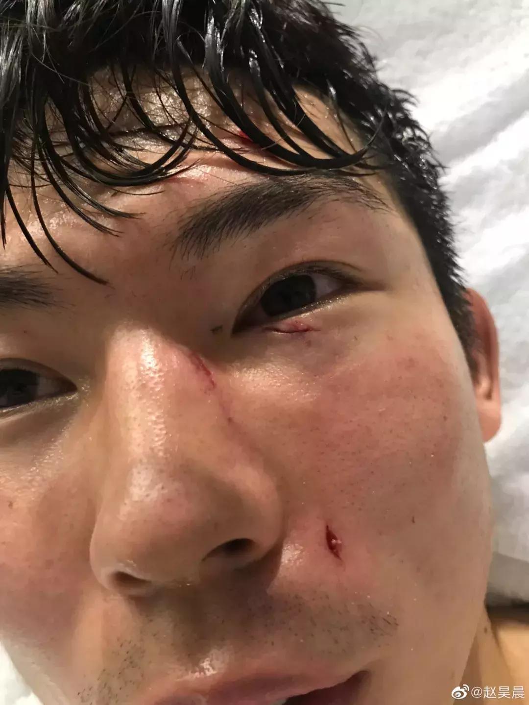 上港杨世元,上港杨世元亚冠