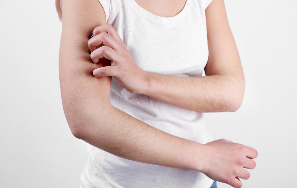 冬天皮肤痒怎么办,医生冬天皮肤痒最快解决方法