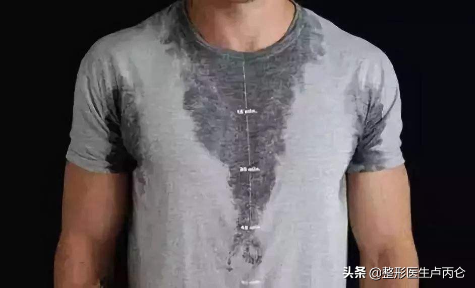 肉毒素治疗多汗症维持多久,肉毒毒素治疗腋下多汗多久起效