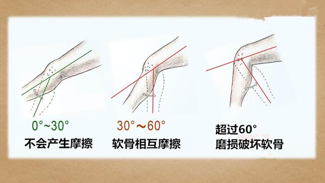 蹲马步护膝,蹲腿护膝应该选什么样的
