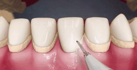 值得收藏的牙齿护理时间表,怎么护理牙齿才能用一辈子