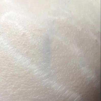 又到了穿小裙的季节，鸡皮女孩该怎么办……