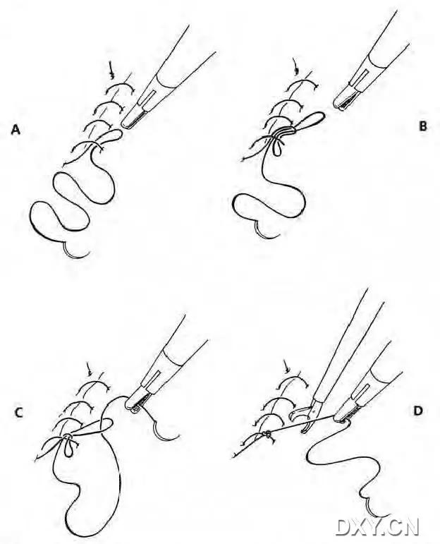 实用大全：腹腔镜下缝合与打结