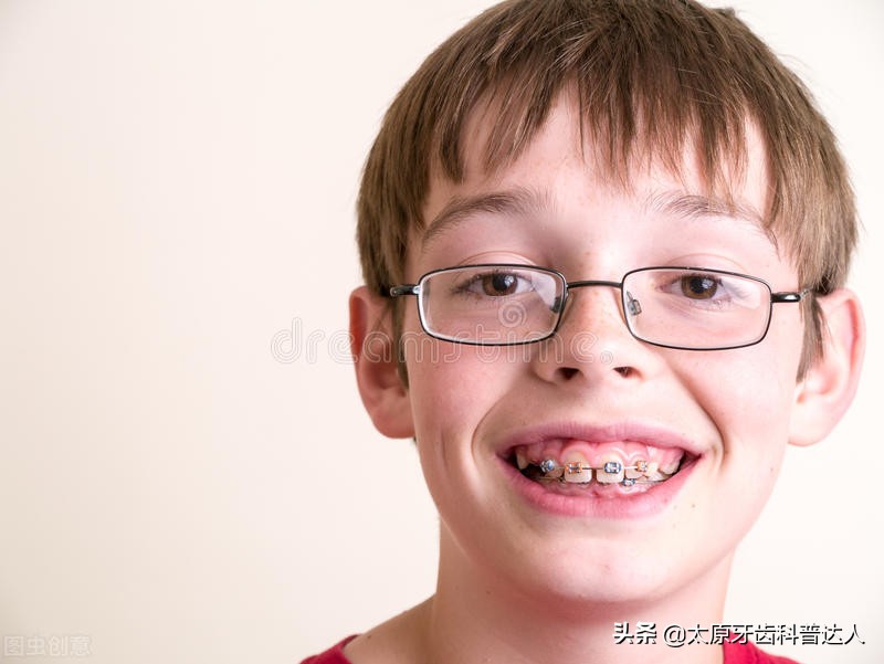 嘴凸龅牙闭不上嘴咋办,有龅牙怎么办