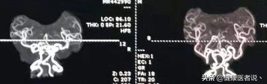 小孩头发卷曲是咋回事,小孩头发卷曲一根头发不均匀