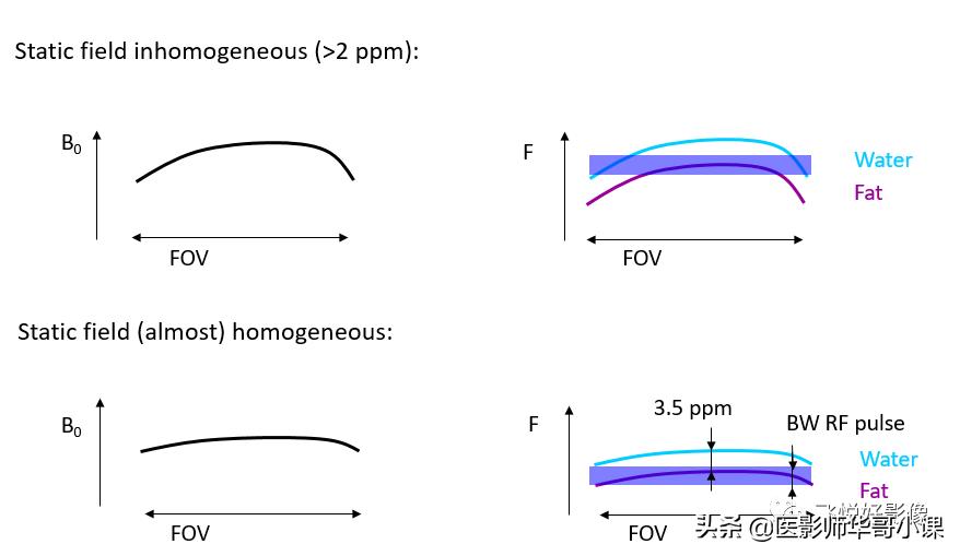 飞利浦磁共振独有技术,飞利浦磁共振减影技术
