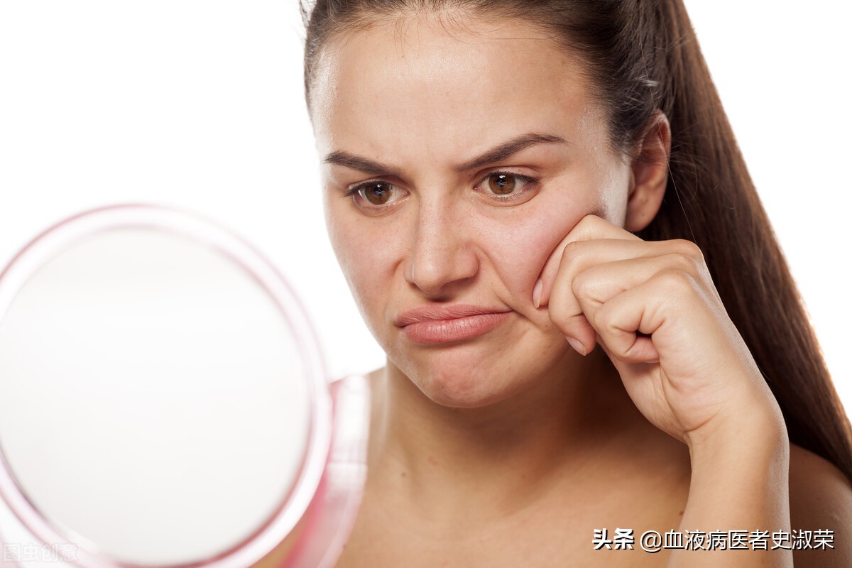 过敏性紫癜反复复发该怎么缓解,过敏性紫癜好了以后怎样避免复发