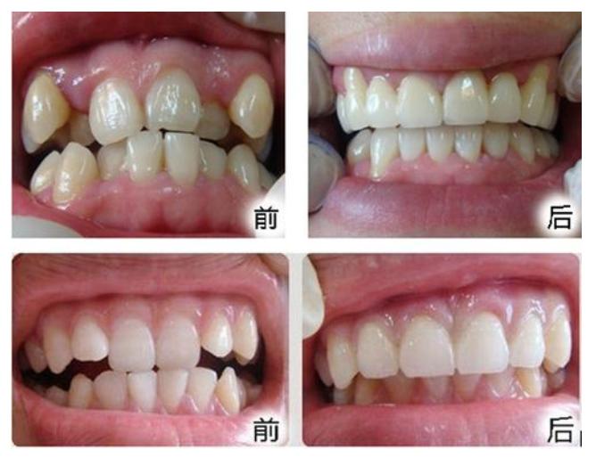 12-18岁属于什么阶段,矫正一月龄从什么时候开始算