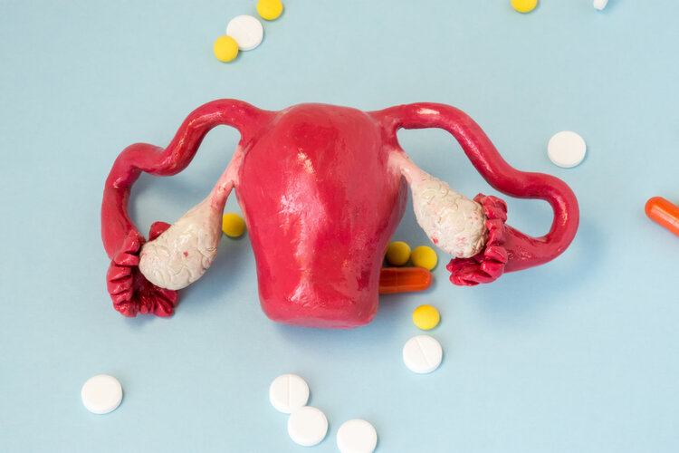 妇科病盆腔积液好治吗,盆腔积液医生说有点盆腔炎严重吗