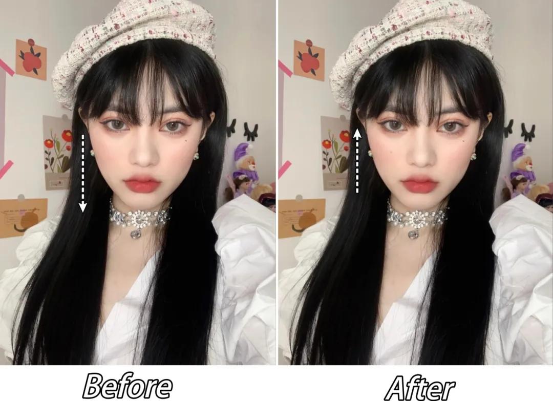 点痣就能变美,点痣整容大法